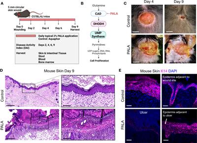 A novel murine model of pyoderma gangrenosum reveals that inflammatory skin-gut crosstalk is mediated by IL-1β-primed neutrophils